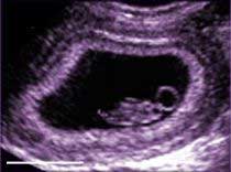 ������� ������������ � ��������. ����� ��������� ���������, �� (��������� ABC News).