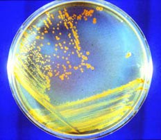   Deinococcus radiodurans.