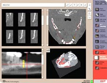 ILS     ,    ,         (   tactile-tech.com).