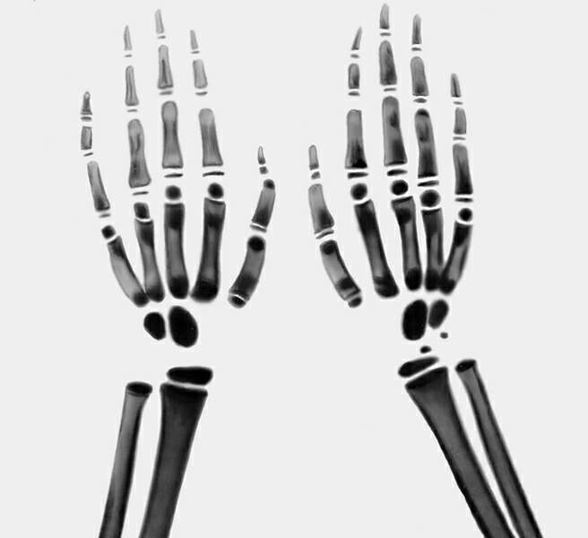 �������� �� ��������