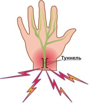 �������� �� ��������