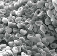 ������� ����� �� ������ ��� ����������� ����������� ����������� (���� � ����� en.wikipedia.org).