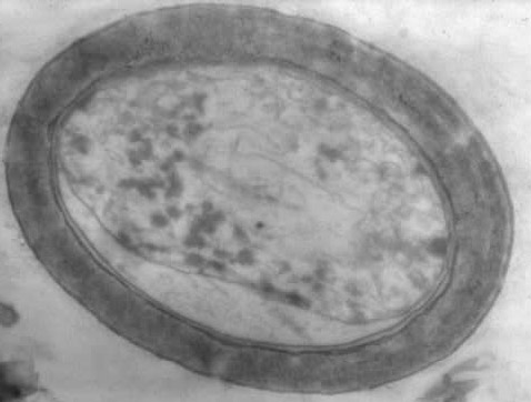 ������������ "������" �� ���� ������ �������� �����. ���������� 20 ����� ��� (���� � ����� en.wikipedia.org).